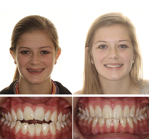 smile results